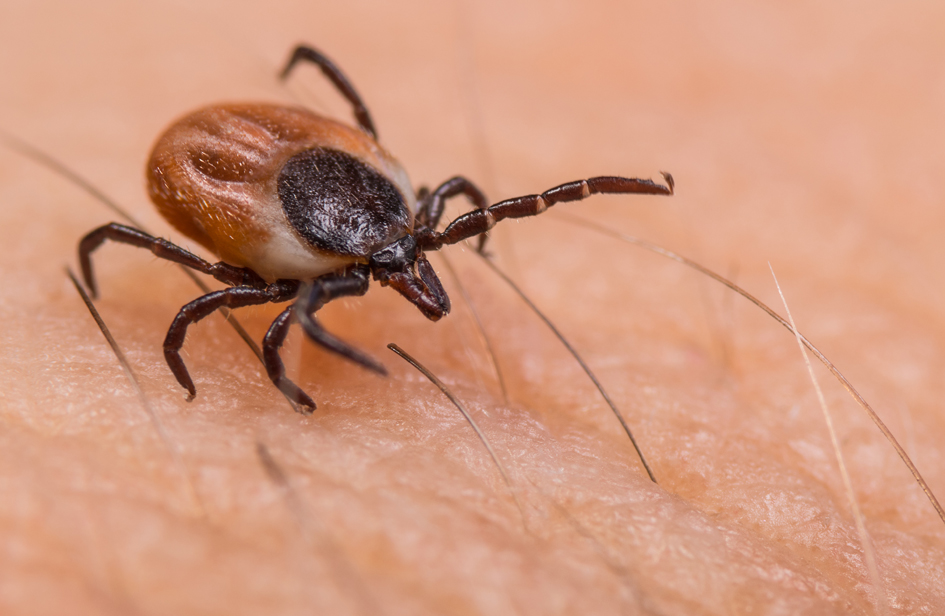 A Tick On A Human Body